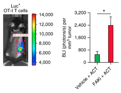 Targeting focal adhesion kinase renders pancreatic cancers responsive to checkpoint immunotherapy