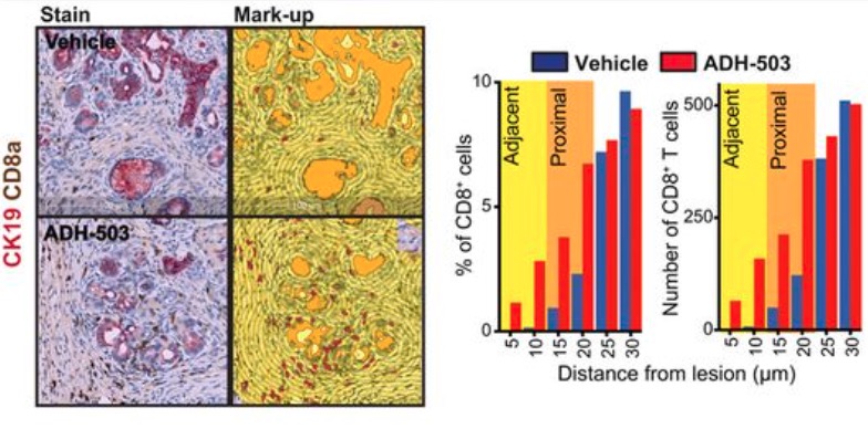 Agonism of CD11b reprograms innate immunity to sensitize pancreatic cancer to immunotherapies