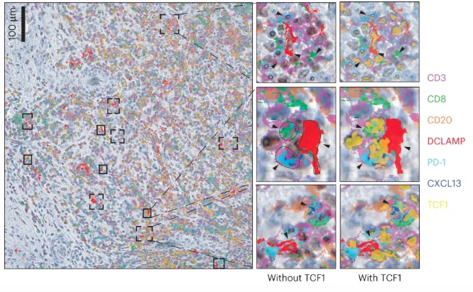 Intratumoral dendritic cell CD4 T helper cell niches enable CD8 T cell differentiation following PD-1 blockade in hepatocellular carcinoma