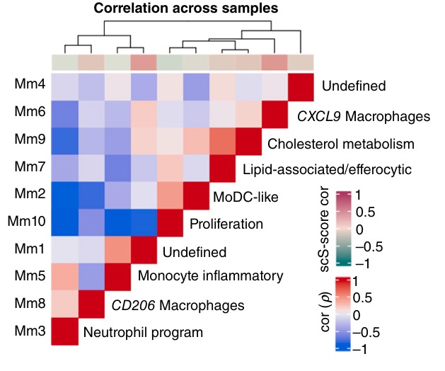 Single-Cell View of Tumor Microenvironment Gradients in Pleural Mesothelioma