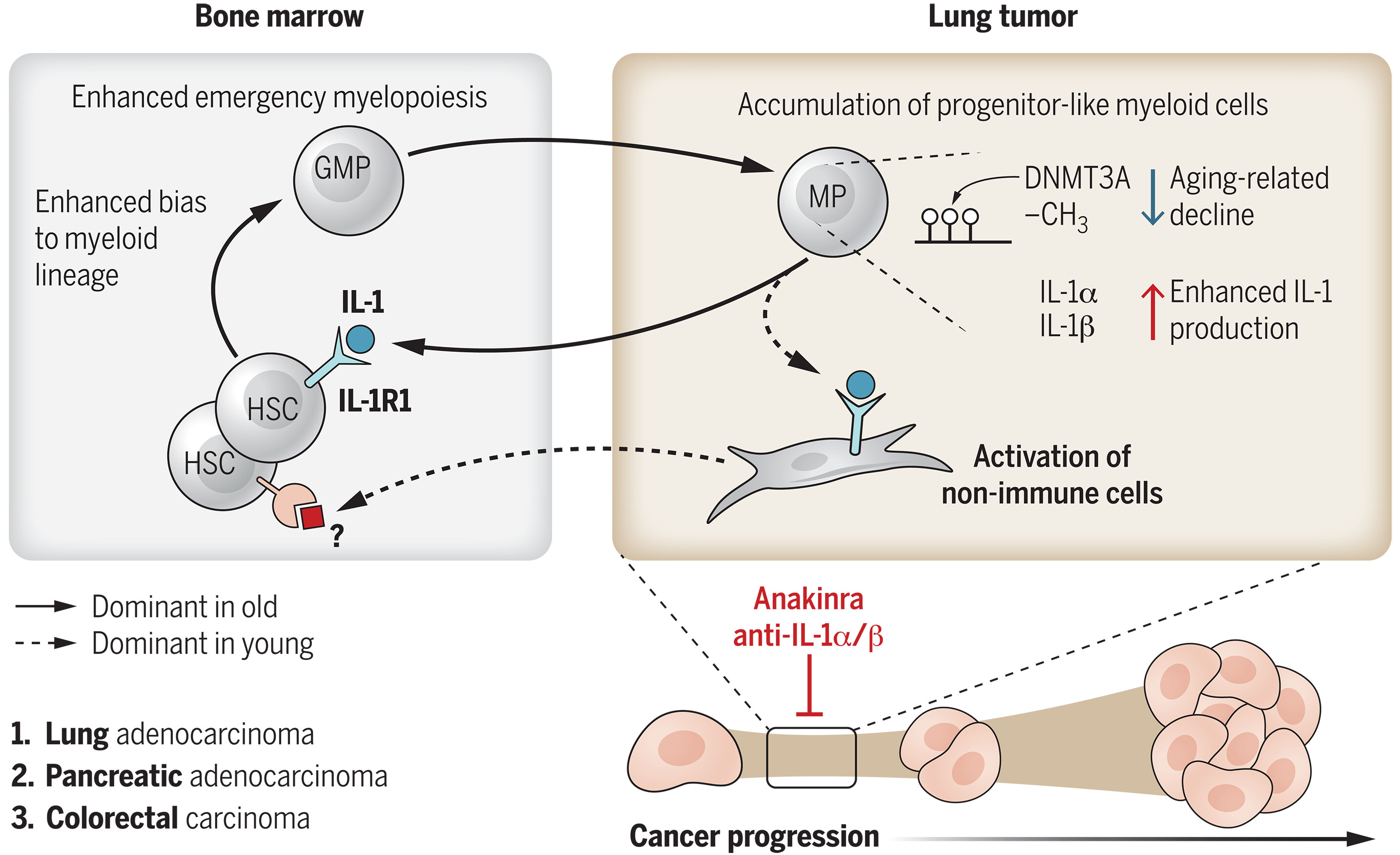 Hematopoietic aging promotes cancer by fueling IL-1 driven emergency myelopoiesis