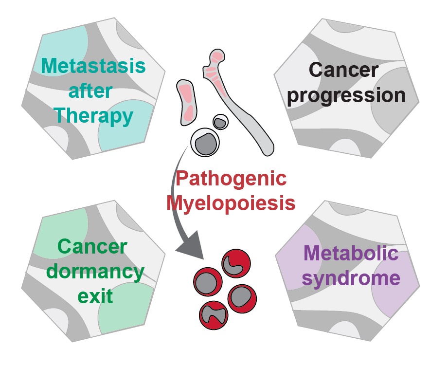 Role of myelopoiesis in various aspects of cancer inflammation